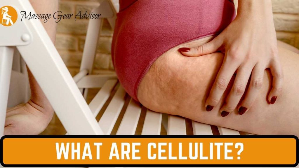 What are Cellulite?
